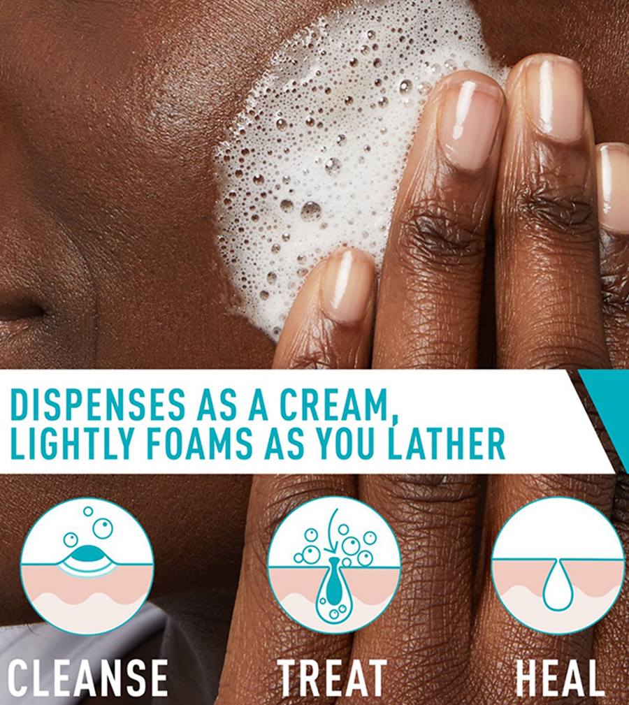 CeraVe Acne Foaming Cream Cleanser – 4% Benzoyl Peroxide Treatment [120ml]