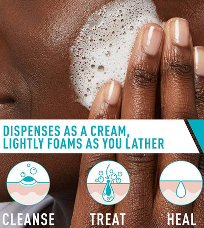 CeraVe Acne Foaming Cream Cleanser – 4% Benzoyl Peroxide Treatment [120ml]