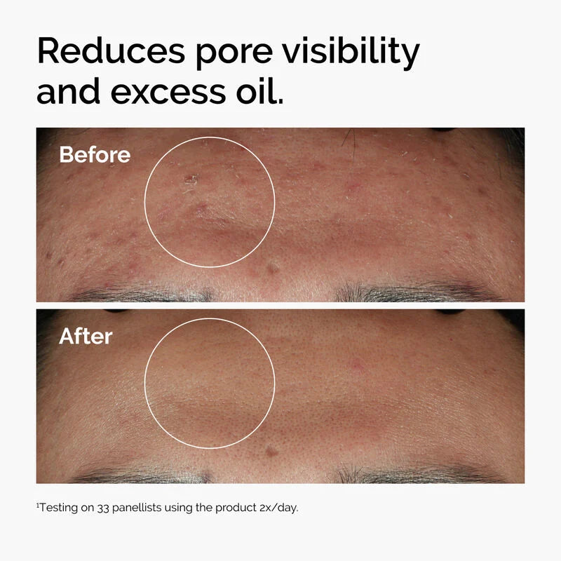 The Ordinary Niacinamide 10% + Zinc 1% Serum – 30ml