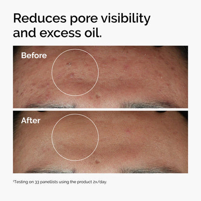 The Ordinary Niacinamide 10% + Zinc 1% Serum – 30ml